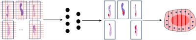 A mucosal recovery software tool for endoscopic submucosal dissection in early gastric cancer